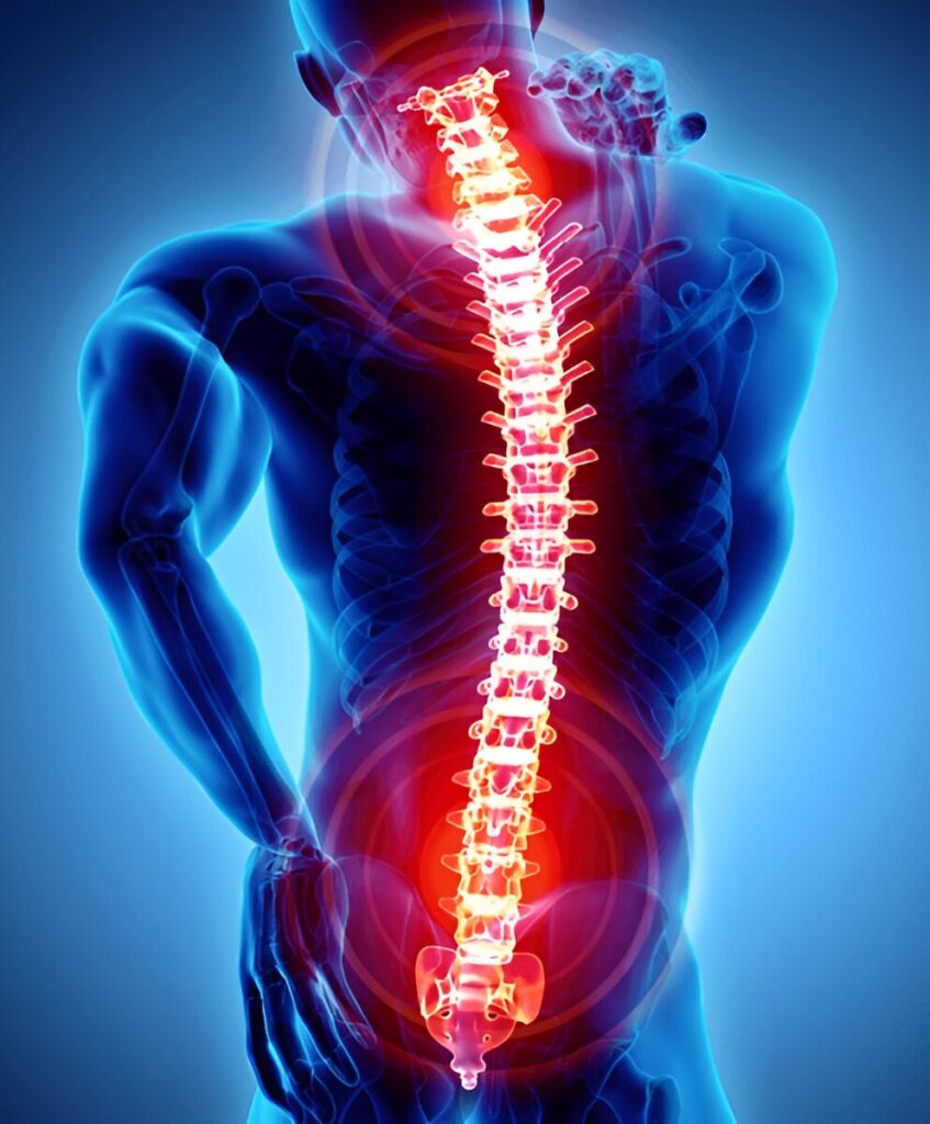 Spine Pain Image