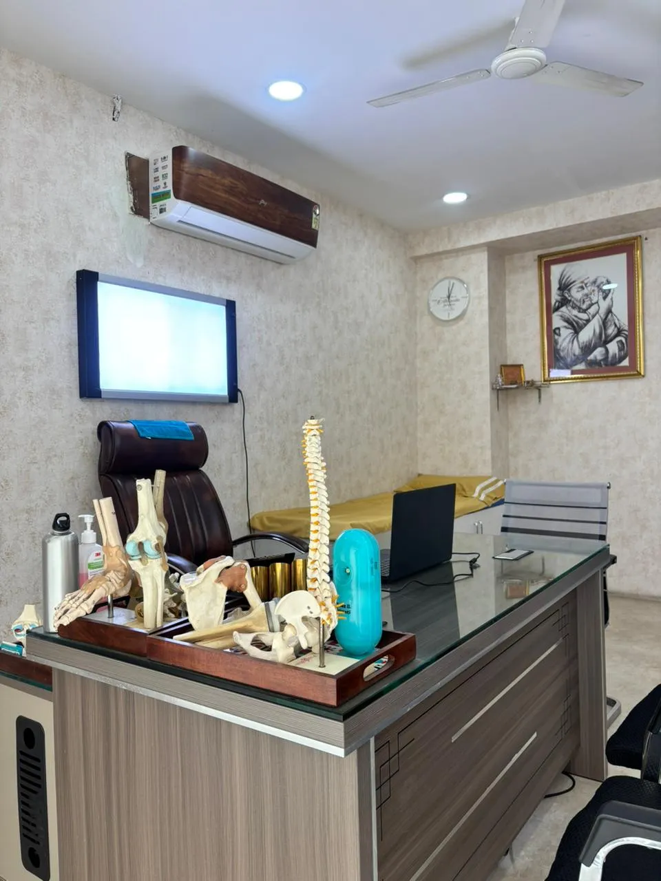 Consultation desk at Sharada Orthopaedic Centre, Bowenpally, with anatomical bone models used to explain treatment