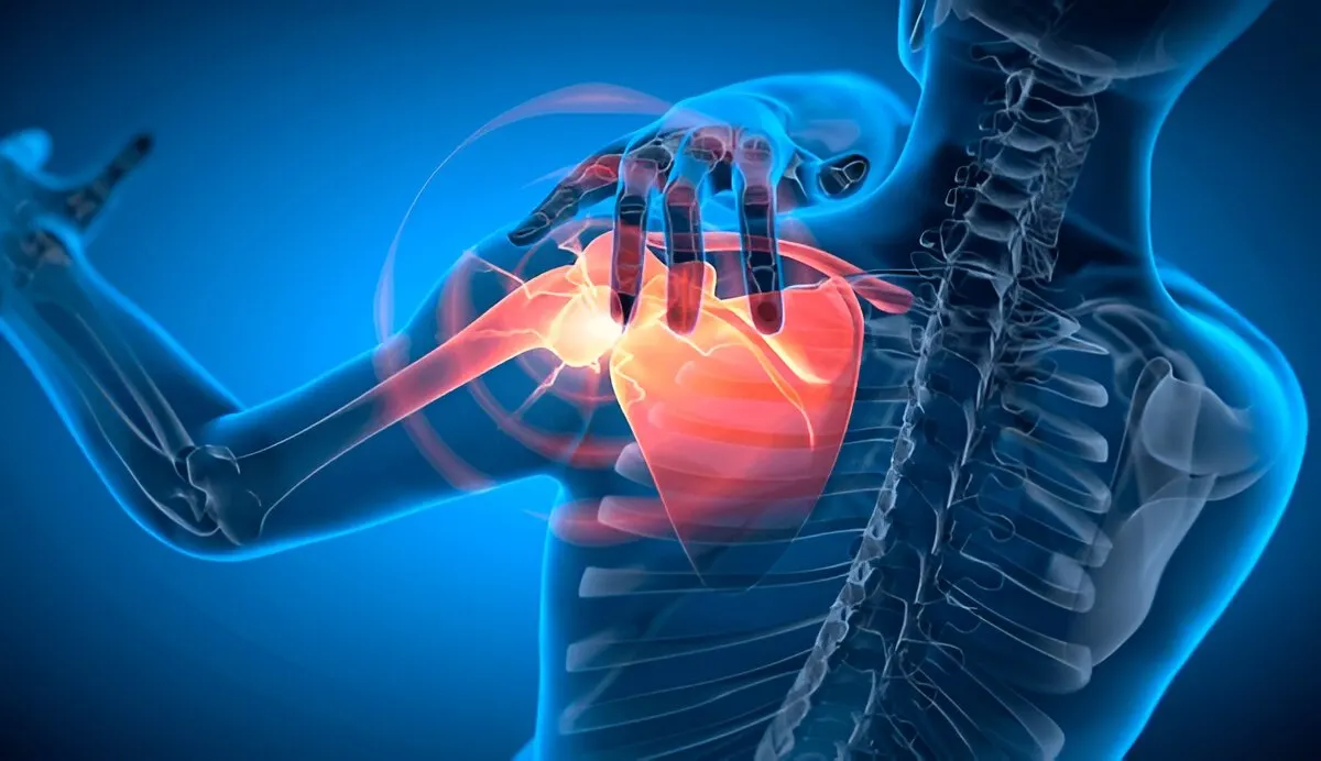 Illustration of the shoulder joint showing the area affected in frozen shoulder